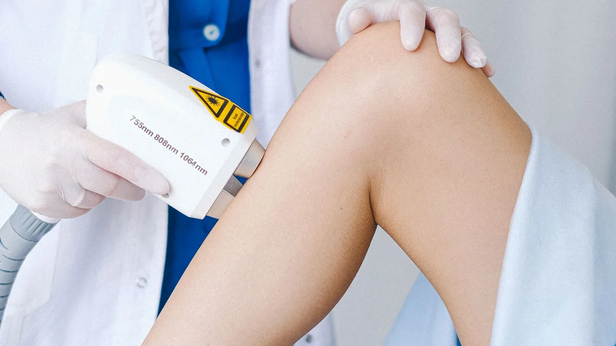 Laser hair removal