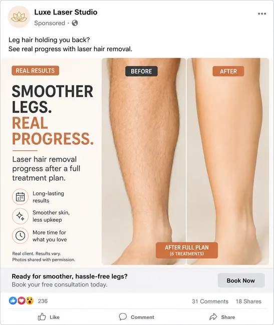 Laser Hair Removal Before-and-after ads